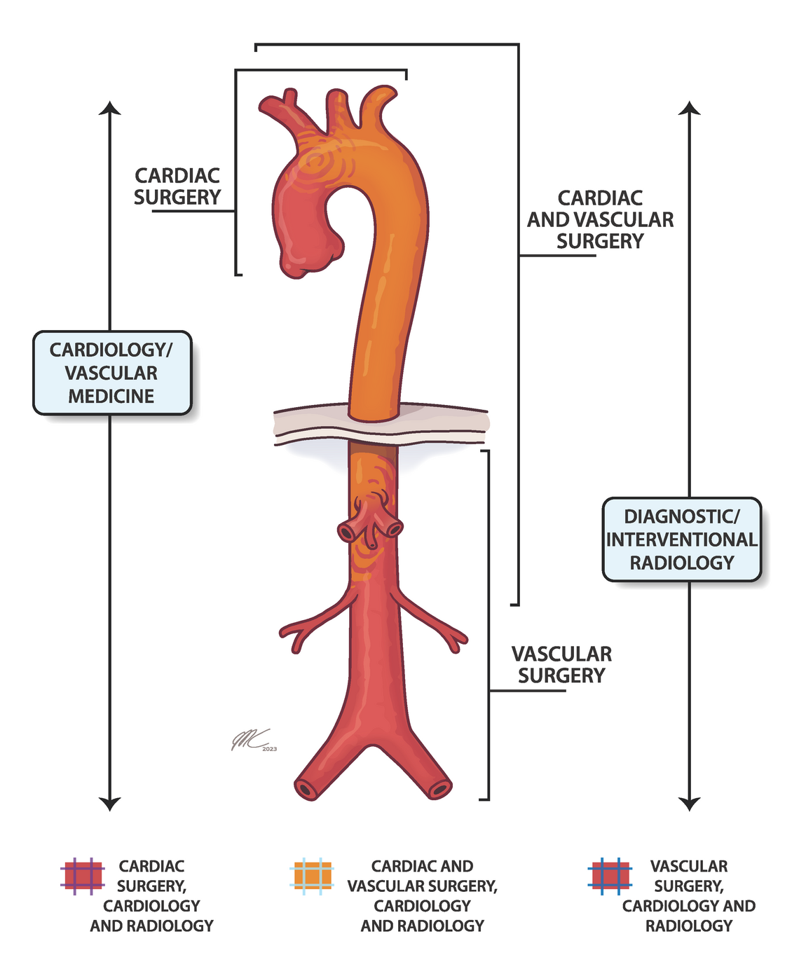 Illustrated image of an Aorta